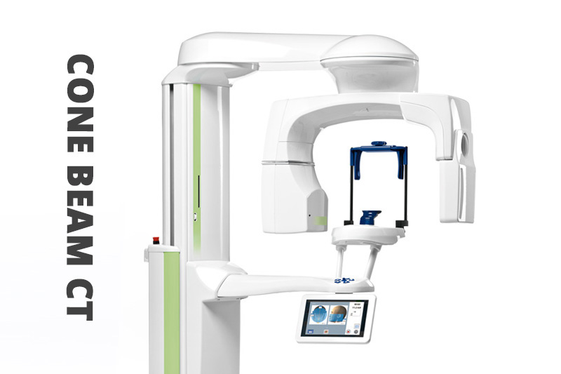 Cone Beam CT Imaging in San Antonio